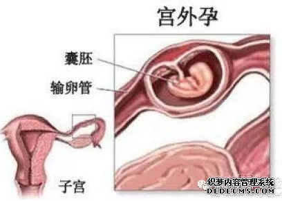 马鞍山和县人流手术失败，难道她怀了个猪坚强?